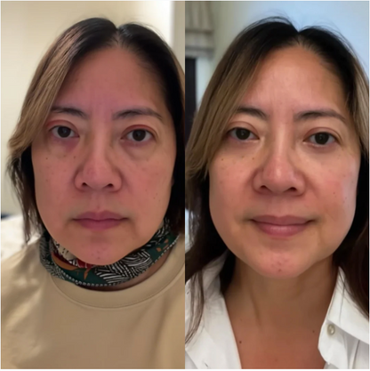 LUMIVUE™ Eye Recovery Pro Innovatives Augenpflegegerät mit Massage- & Lichttechnologie